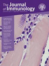 JOURNAL OF IMMUNOLOGY雜志封面
